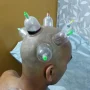Full Head Cupping